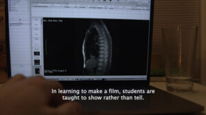 Hand typing at a computer. Screen showing an image of a spinal x-ray. Overlaid with the words "In learning to make a film, students are taught to show rather than tell."